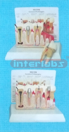 WEST DESK TYPE, ANATOMICAL DISEASES (COMMON PATHOLOGIES) TEETH WITH DESCRIPTION PLATE